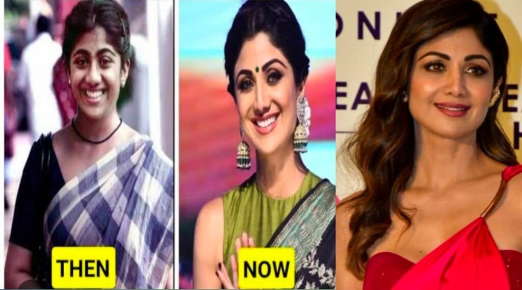 Bollywood Stars Who Transformed